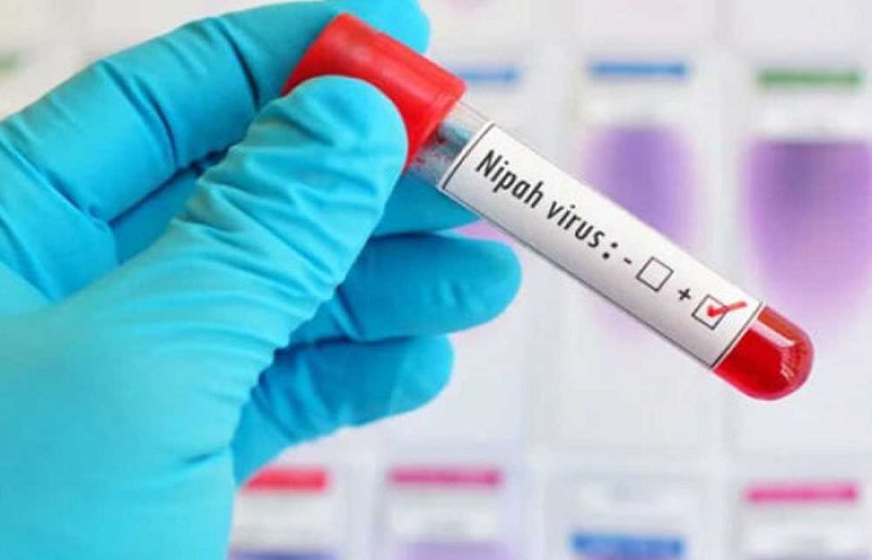 Photo of NIH issues advisory on Nipah virus