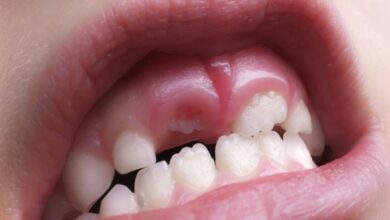Photo of Breakthrough drug to regrow teeth set for human trials